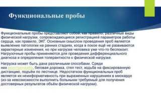 ЭКГ с нагрузкой