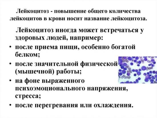 Физиологический лейкоцитоз