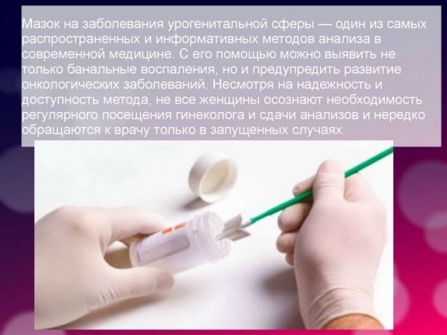 Урогенитальный мазок